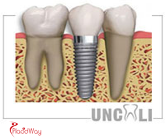 Slider image (4) Uncali Oral and Dental Clinic